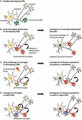 Microglia Gone Rogue: Impacts on Psychiatric Disorders across the Lifespan